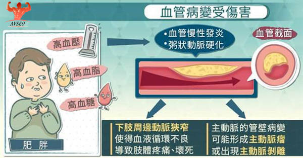 下肢冰冷、疼痛的周邊動脈阻塞